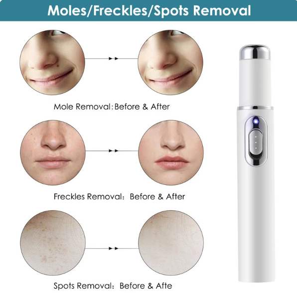 NUEVO LÁPIZ LÁSER PARA ELIMINAR MANCHAS O ACN