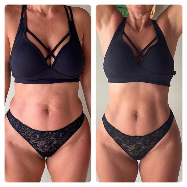 💫 BodyClean 360 —3x1 ( 90 unidades) – Adelgazante + Anti Ansiedad