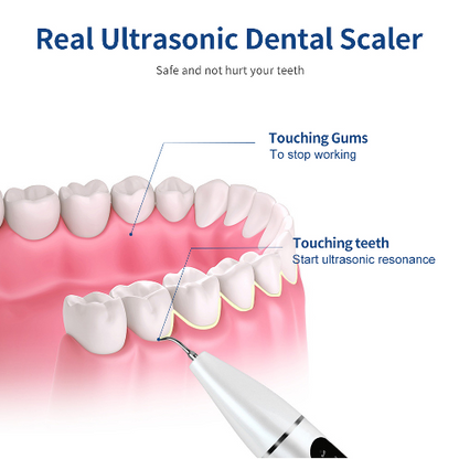 Sistema de limpieza removedor de placa dental