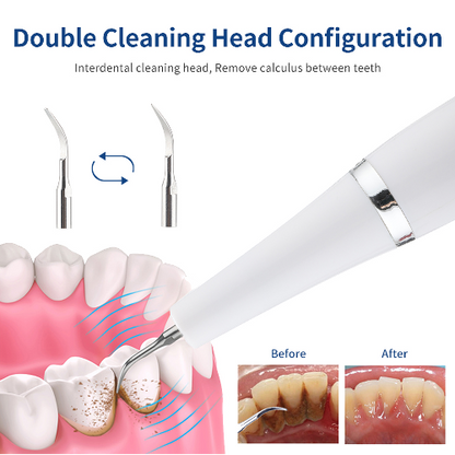 Sistema de limpieza removedor de placa dental